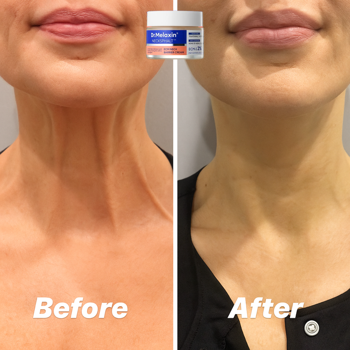 Perfect Neck -  Neck Firming