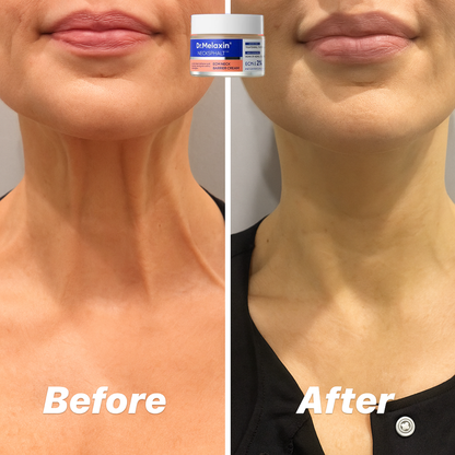 Perfect Neck -  Neck Firming