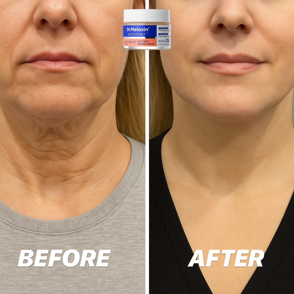 Perfect Neck -  Neck Firming