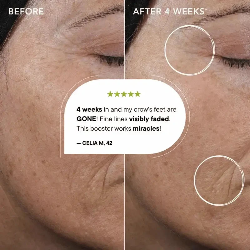 Retinal Tightening Booster - See tighter, smoother skin in just weeks